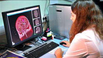 مفاجأة.. الرياضة تحمي الدماغ من أضرار الوجبات السريعة