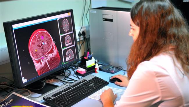 مفاجأة.. الرياضة تحمي الدماغ من أضرار الوجبات السريعة