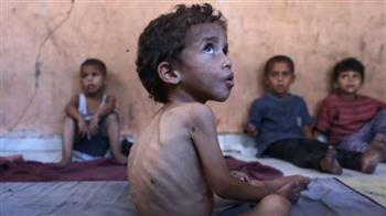 عضو بالحزب الجمهوري: الفلسطينيون يموتون من الجوع منذ عامين