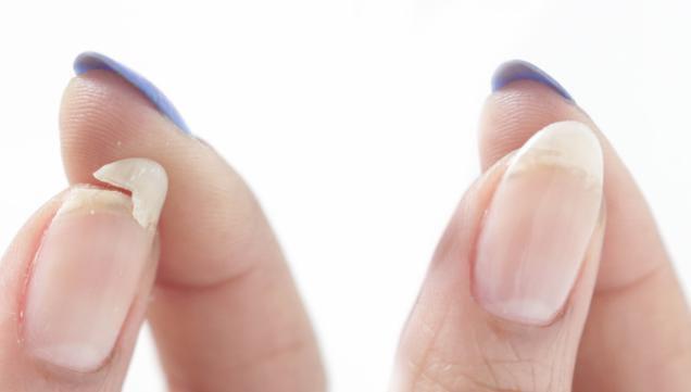 لإصلاح الظفر المكسور في المنزل.. اتبعي تلك الطرق