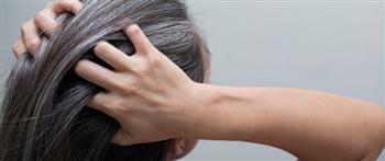 هذه هي الأسباب الرئيسية لظهور الشعر الأبيض