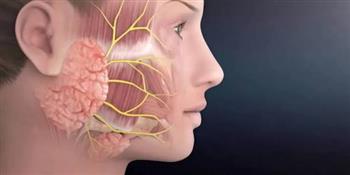 أعراض تكون حصوات الغدد اللعابية