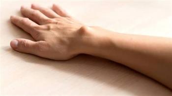 أعراض الورم الكيسي في اليد