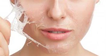 الشتاء أفضل وقت لتقشير البشرة