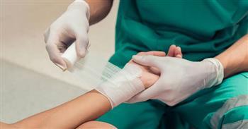 تعرف على الإسعافات الأولية عند التعرض للحروق