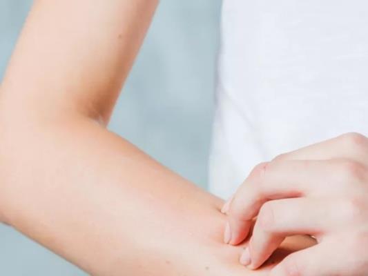 أسباب وأعراض الارتكاريا النفسية