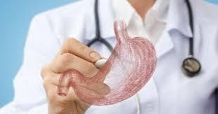 أهم أسباب الإصابة بقرحة المعدة