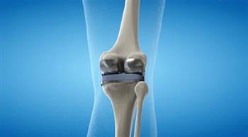 اعراض الفصال العظمي