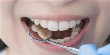 «الصحة» تقدم خطوات بسيطة للحفاظ على صحة أسنانك