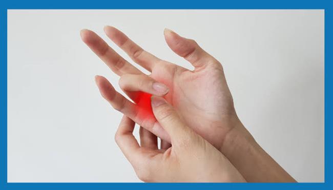 أسباب ظهور إصبع الزناد