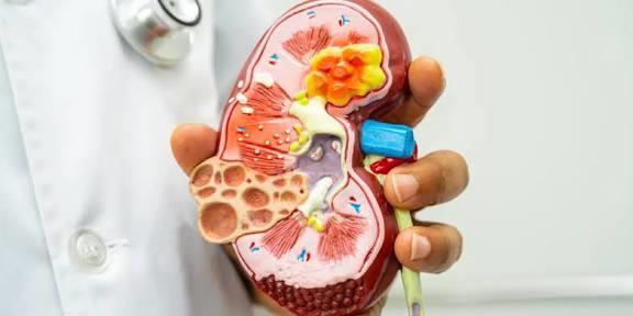 أسباب تكون حصوات الحالب وأعراضها