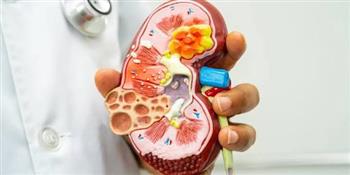 أسباب تكون حصوات الحالب وأعراضها