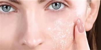 في الشتاء .. تغلب على قشور الجسم البيضاء