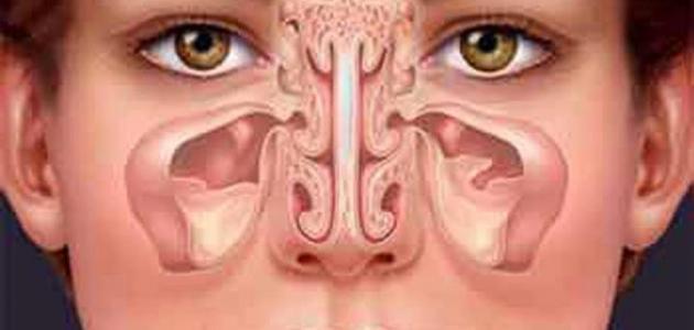 طرق منزلية بسيطة لمواجهة التهاب الجيوب الأنفية