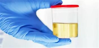 طرق فعّالة لمواجهة رائحة البول