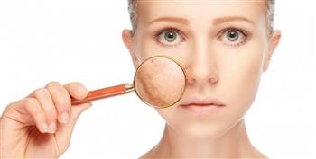 لماذا تُصاب البشرة بالجفاف في الشتاء ؟  