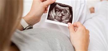 تعرف على أسباب قلة حركة الجنين