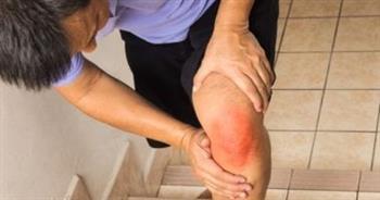 صوت "طقطقة الركبة" طبيعى أم مشكلة ؟