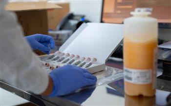 مصر تصبح سادس دولة فى العالم تحقق الإكتفاء الذاتى من البلازما