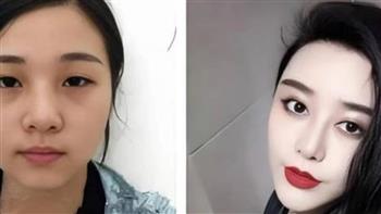 تزوجت طبيب التجميل.. صينية تنفق 8 ملايين لتشبه نجمتها المفضلة