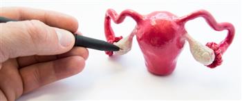 انتبه...مشكلات يسببها  تكيس المبايض