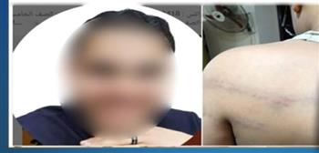 الأمن يحسم الجدل حول واقعة الاعتداء المزعومة على طالب بالدقهلية