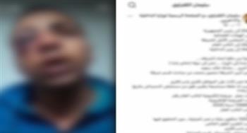 وزارة الداخلية تكشف ملابسات مشاجرة بين سائق وفرد شرطة بمدينة نصر