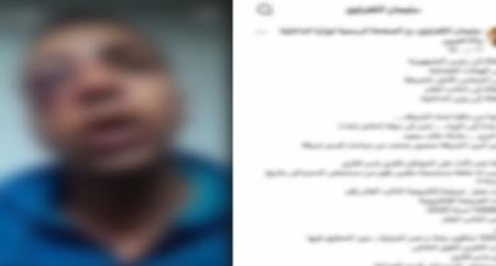 وزارة الداخلية تكشف ملابسات مشاجرة بين سائق وفرد شرطة بمدينة نصر