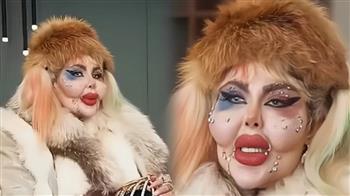 مؤثرة شهيرة تجري 388 عملية تجميل وتمتنع عن الطعام 8 سنوات