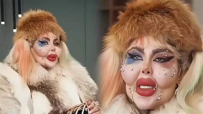 مؤثرة شهيرة تجري 388 عملية تجميل وتمتنع عن الطعام 8 سنوات