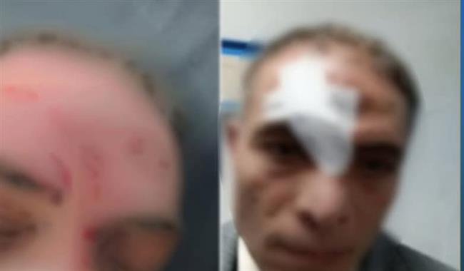 "إصابة موكل مرشح بعد اعتداء منافسه وأنصاره بالمنوفية