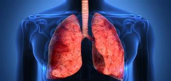 مرض التليف الرئوي ...أخطر الأمراض الصدرية