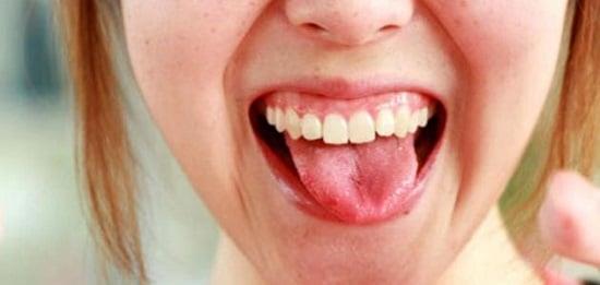 انتبه..التوتر أحد أسباب تنميل اللسان