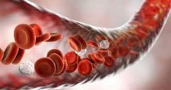 تعرف على أعراض نقص مخزون الحديد