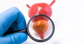 أسباب التهاب البروستاتا..اكتشفها