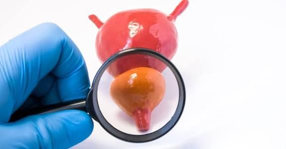 أسباب التهاب البروستاتا..اكتشفها