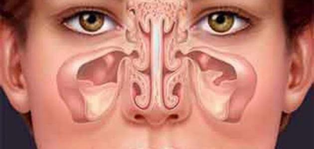 6  نصائح للوقاية من التهاب الجيوب الأنفية