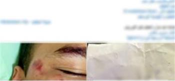 ضبط سائق «فان» دهس طالبًا بالمقطم وفرّ من موقع الحادث