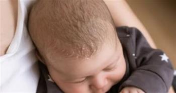 للأمهات الجدد.. أسباب وراء تزايد قشرة رأس رضيعك في الشتاء وطرق للوقاية