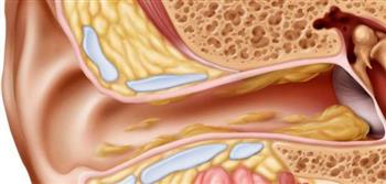 أعراض انسداد قناة استاكيوس وطرق علاج في المنزل