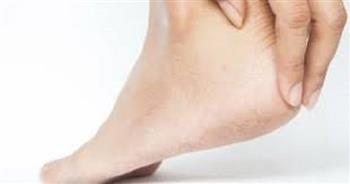 للنساء.. أسباب وراء سماكة جلد القدمين وطرق العناية بها