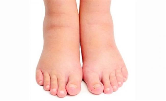 زلال الحمل ..  إحذري تجاهله! 