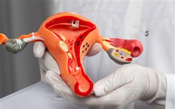 ليست كل أورام عنق الرحم سرطانية