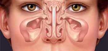 كـيــف نـتـجـنـب الـتـهـاب الـجـيــوب الأنـفـيـة ؟