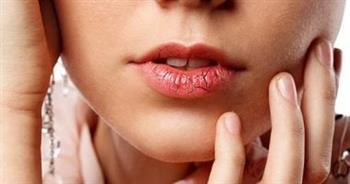3  طرق لعلاج الحروق البسيطة في الشفاه