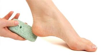 5 مشكلات صحية وراء جفاف وتشقق الكعبين