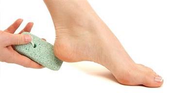 5 مشكلات صحية وراء جفاف وتشقق الكعبين