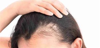 علامات وأعراض التهاب بصيلات الشعر