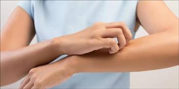 أسباب الشعور بحكة بدون مرض واضح!