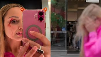 تركها تنزف.. طائر يهاجم مراسلة تلفزيونية على الهواء (فيديو)